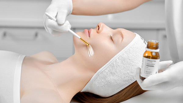 Химический пилинг лица: что это, виды, показания, как проходит процедура