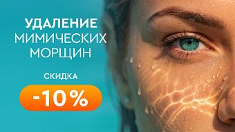 Удаление мимических морщин -10%