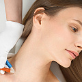 Микродермабразия для лица и тела («Парижский пилинг»): что это такое и кому подходит